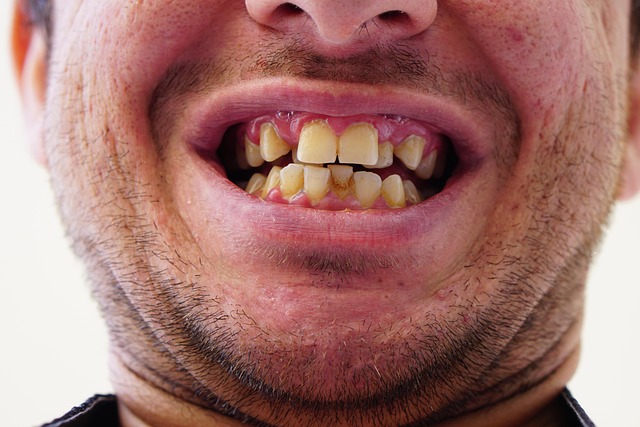 Invisalign for begyndere